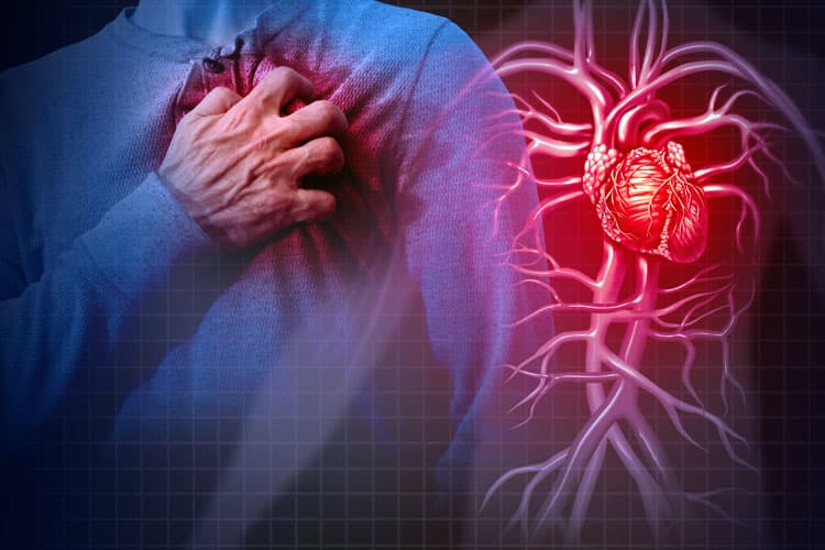 Aritmia, Pembunuh Sunyi di Usia Muda